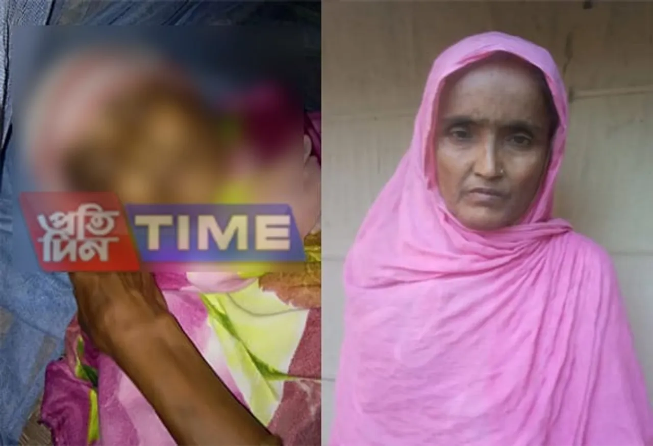 Sister dies after her sibling’s demise in Batadrava