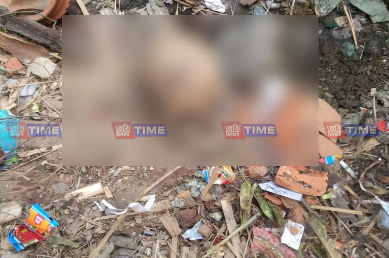 Human skull recovered from dustbin in Guwahati