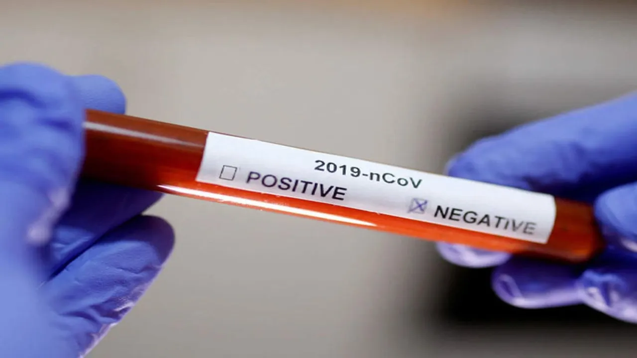 Mizoram Reports 2nd Case of COVID-19