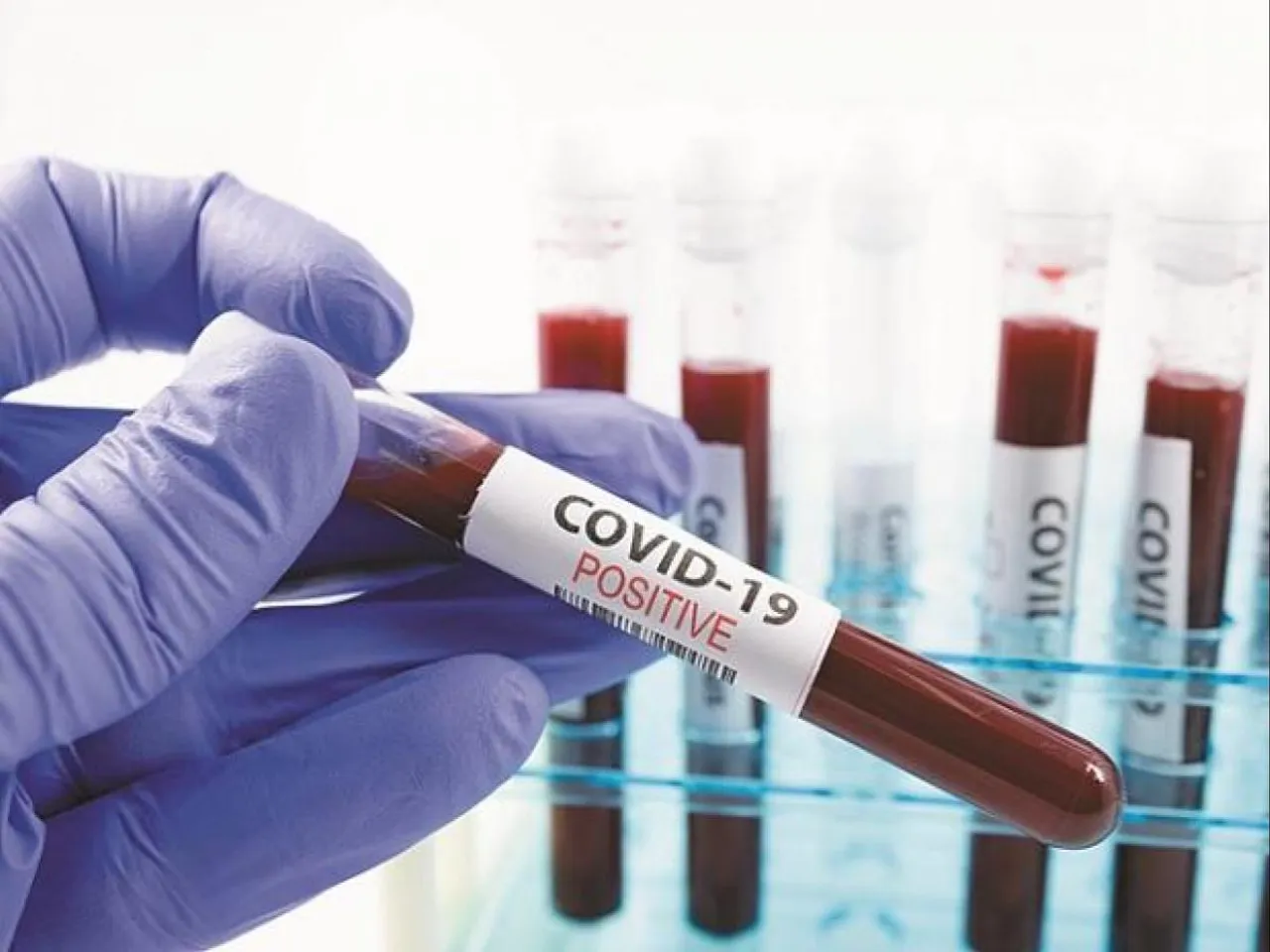 Sivasagar: 8 new COVID-19 cases reported