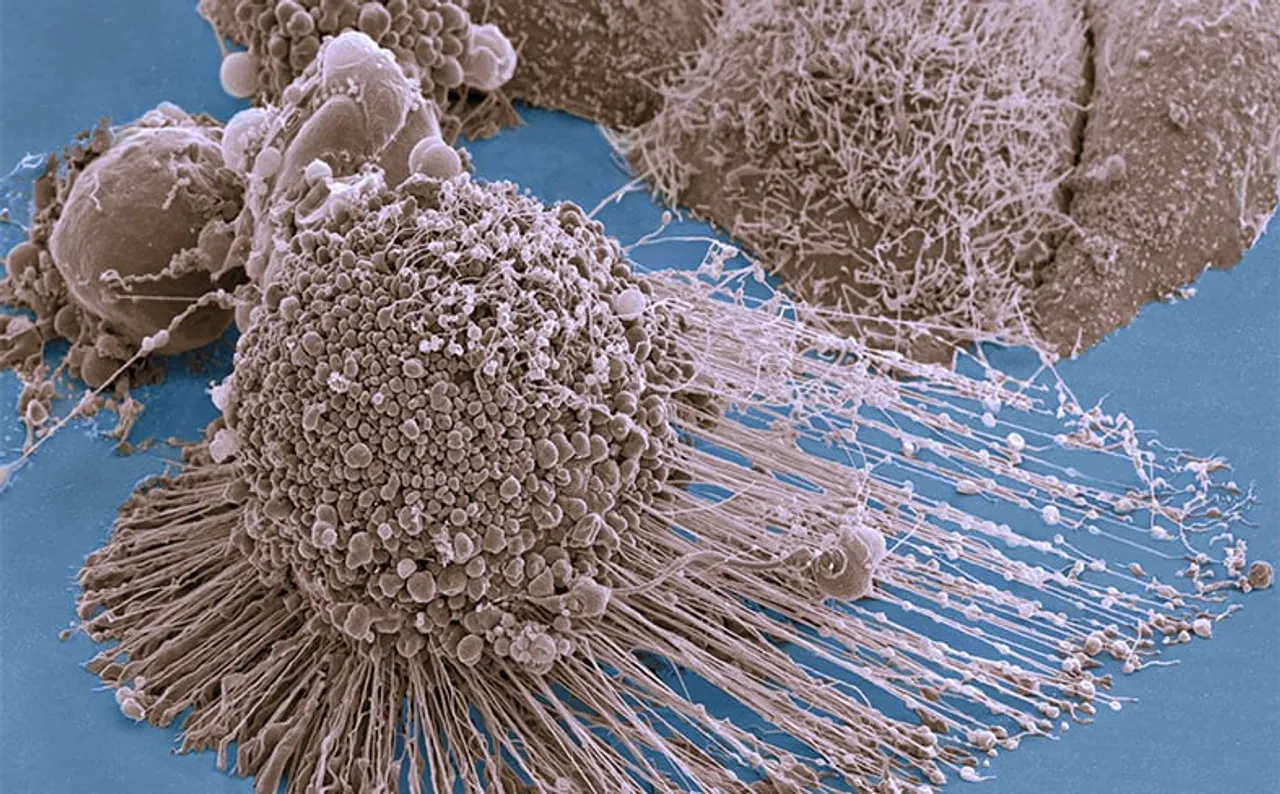 IIT-G, NECHRI To Boost Cancer Research