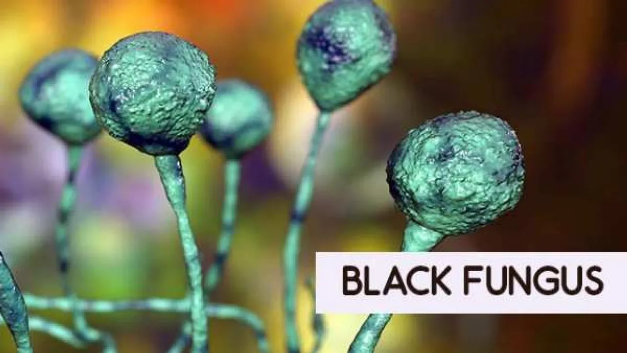 Black Fungus Patient Treated And Discharged: Guwahati