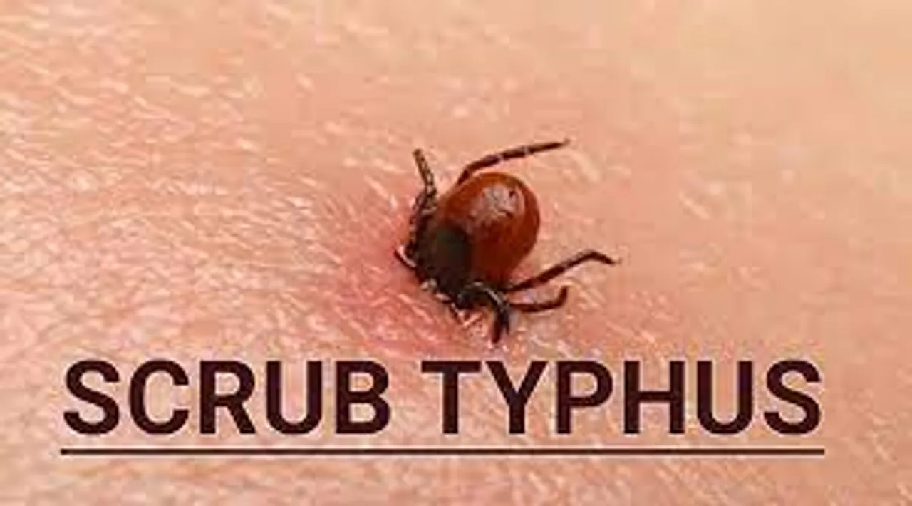 Guwahati: 7 Including Doctors Infected with ‘Scrub Typhus’