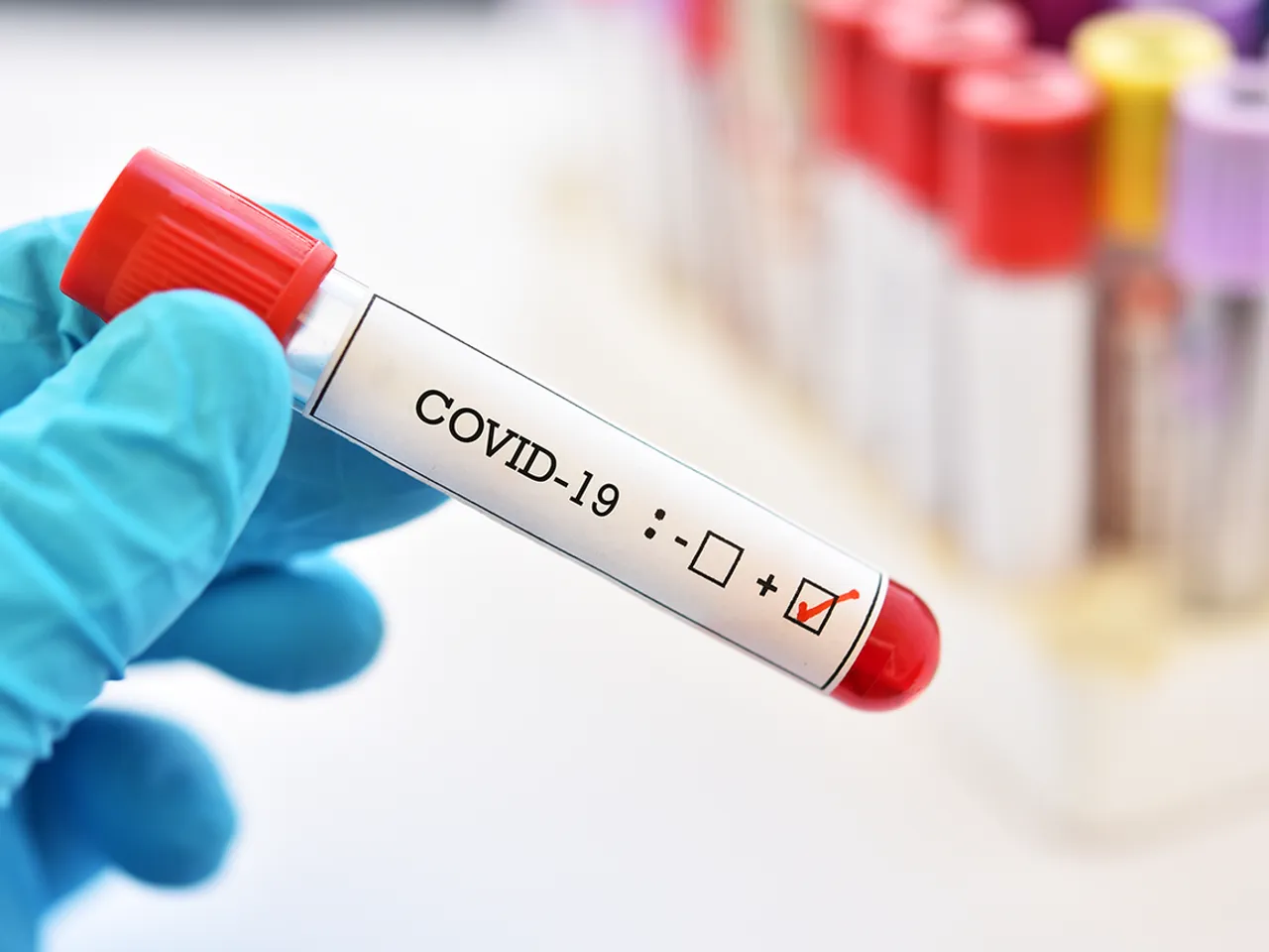 Maharashtra: 16 Students of a School in Navi Mumbai Test COVID-19 Positive