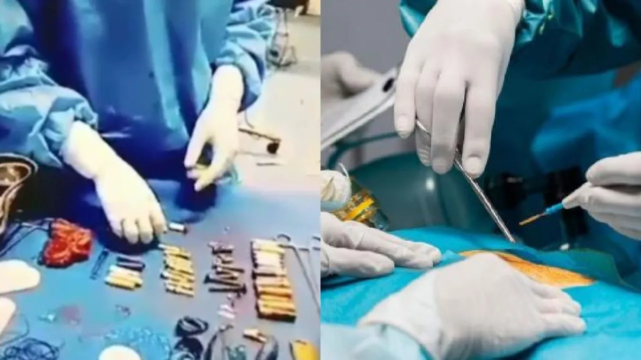 surgery 