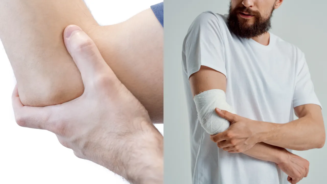 Elbow