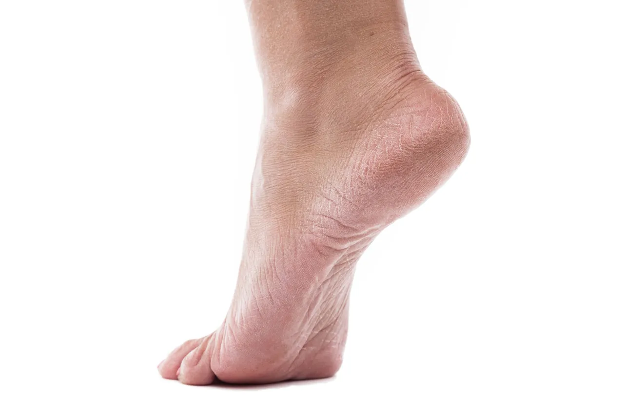 Crackedheels5