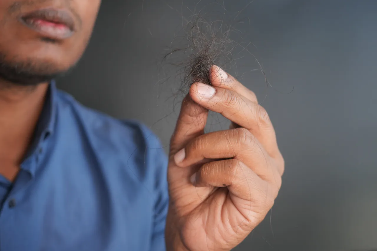 hairfall101