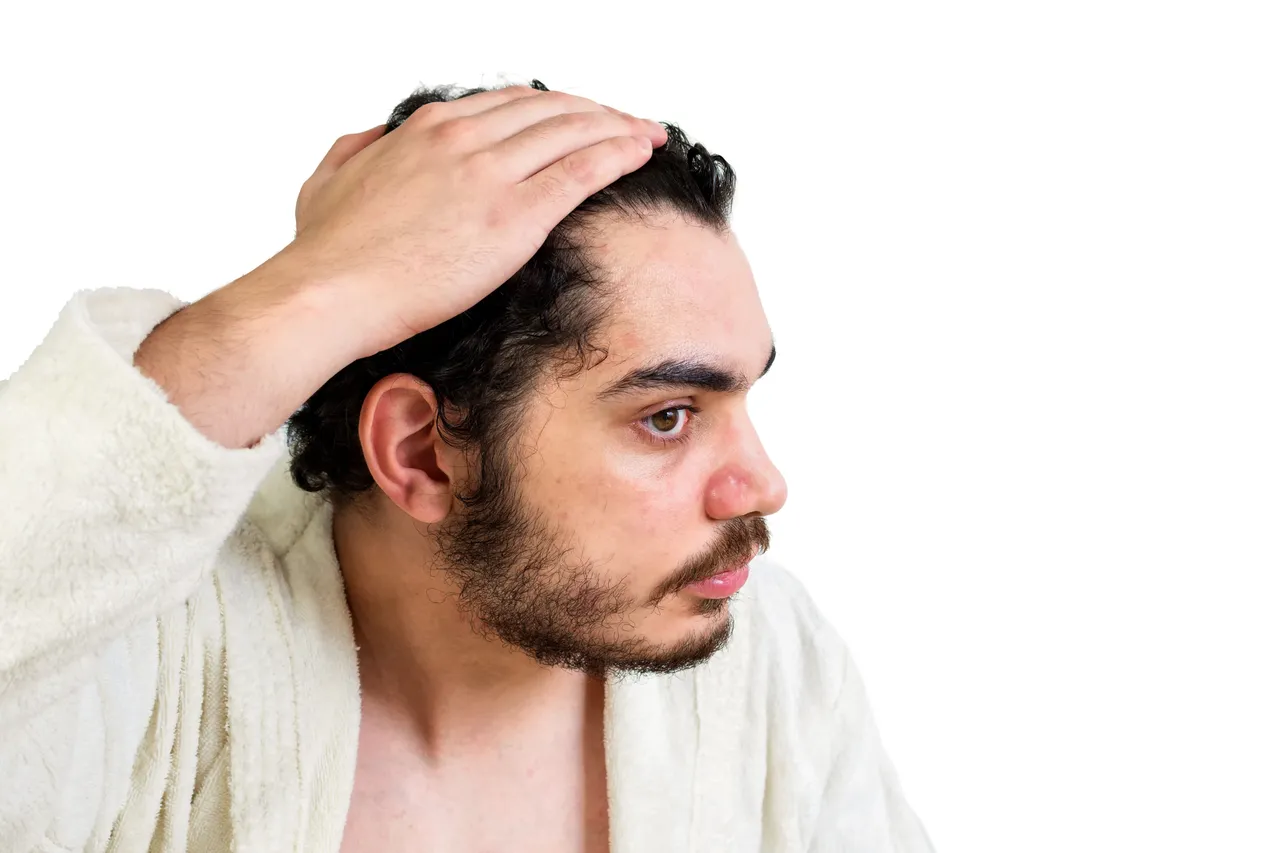 hairfall61
