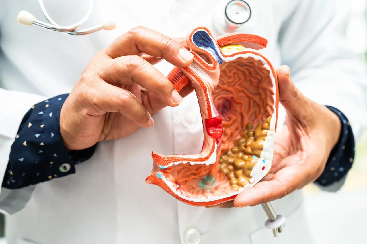 Cholesterol1