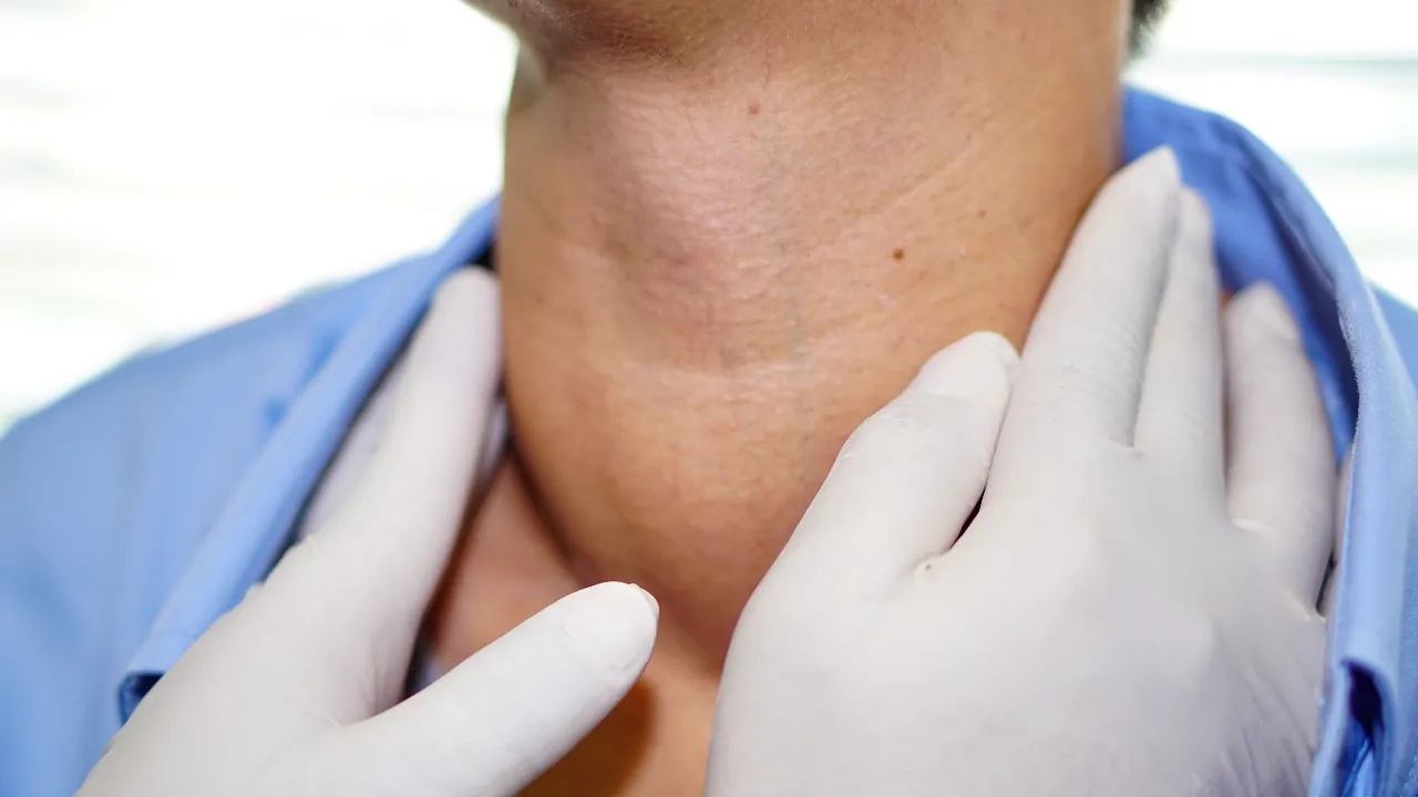 Thyroid