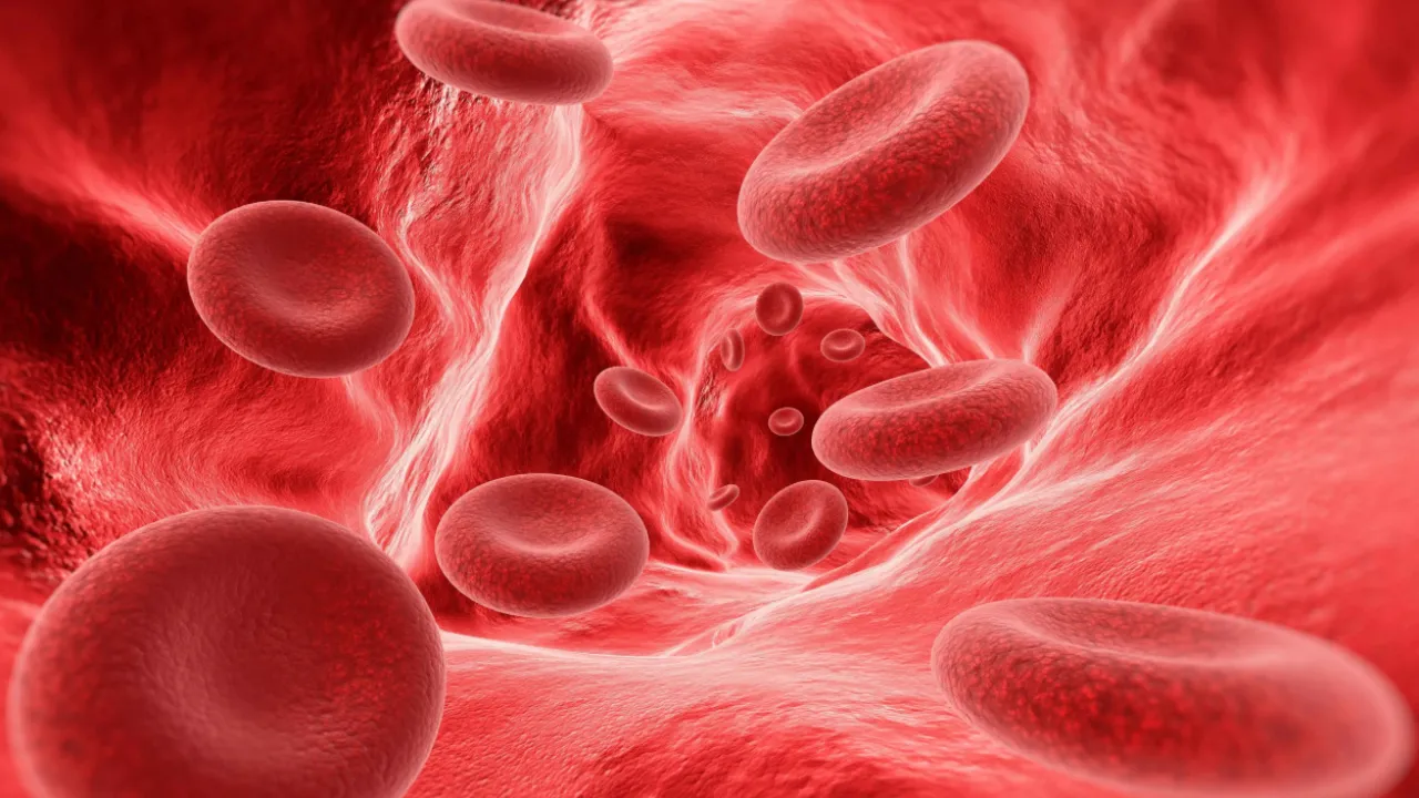 anemia