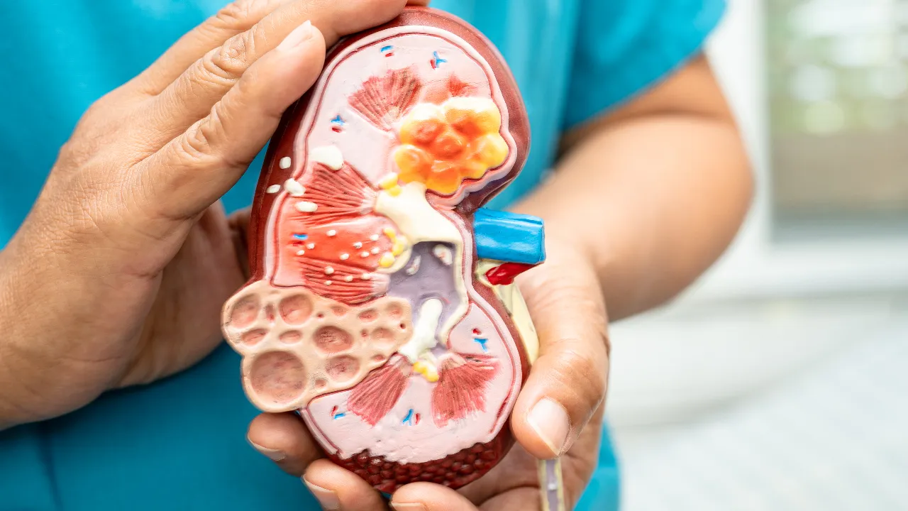 kidney problem