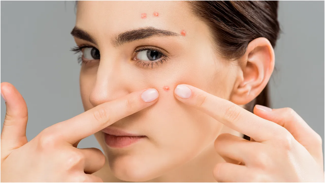 Pimples face