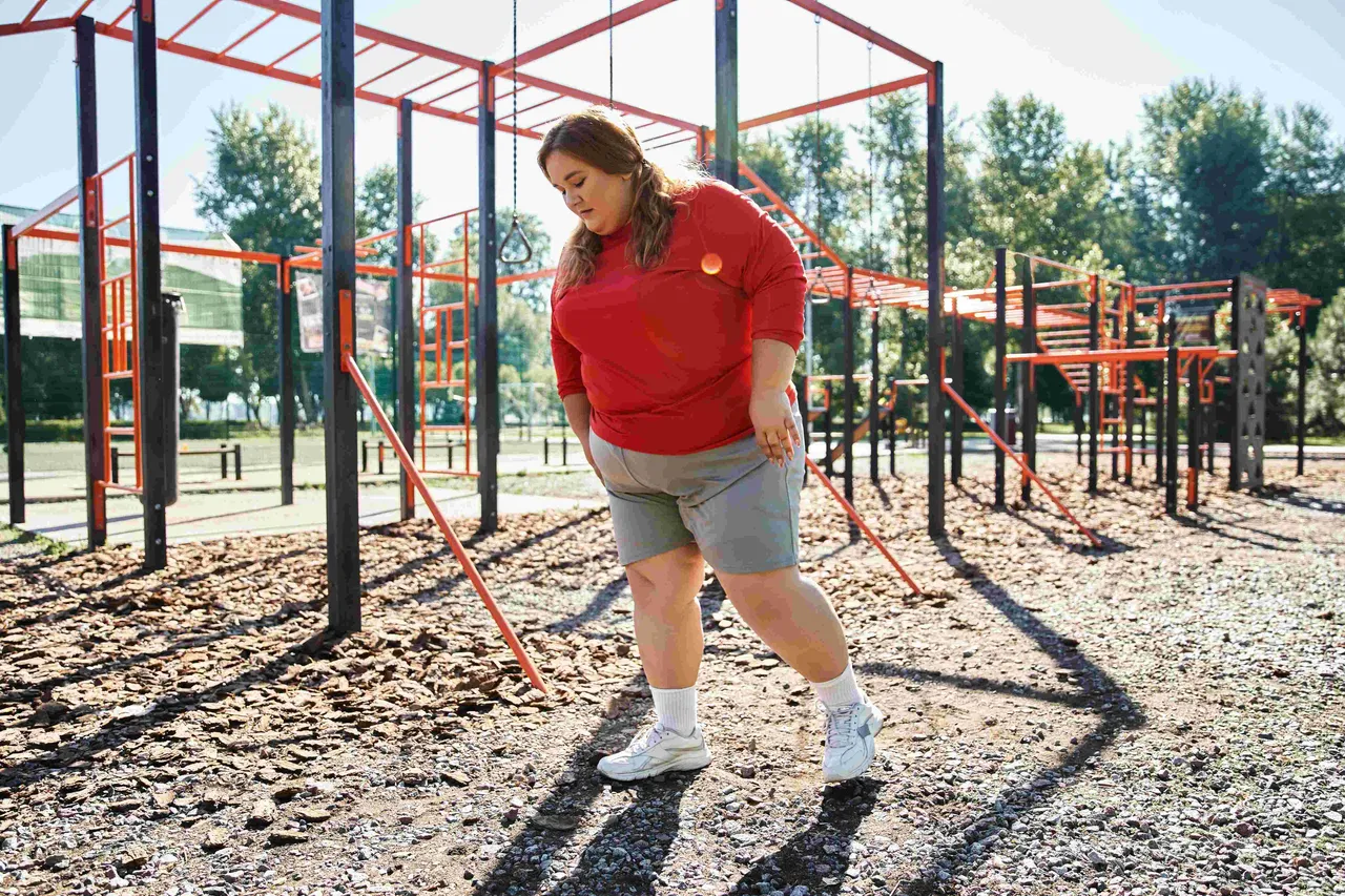obesity