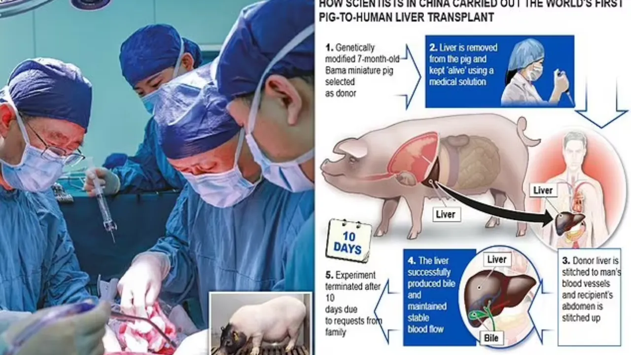 transplant pig liver into man
