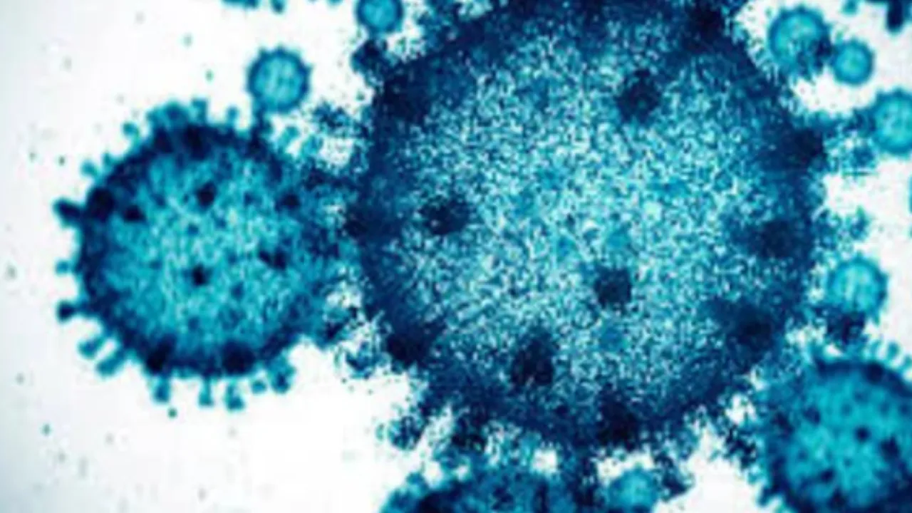 virus russia