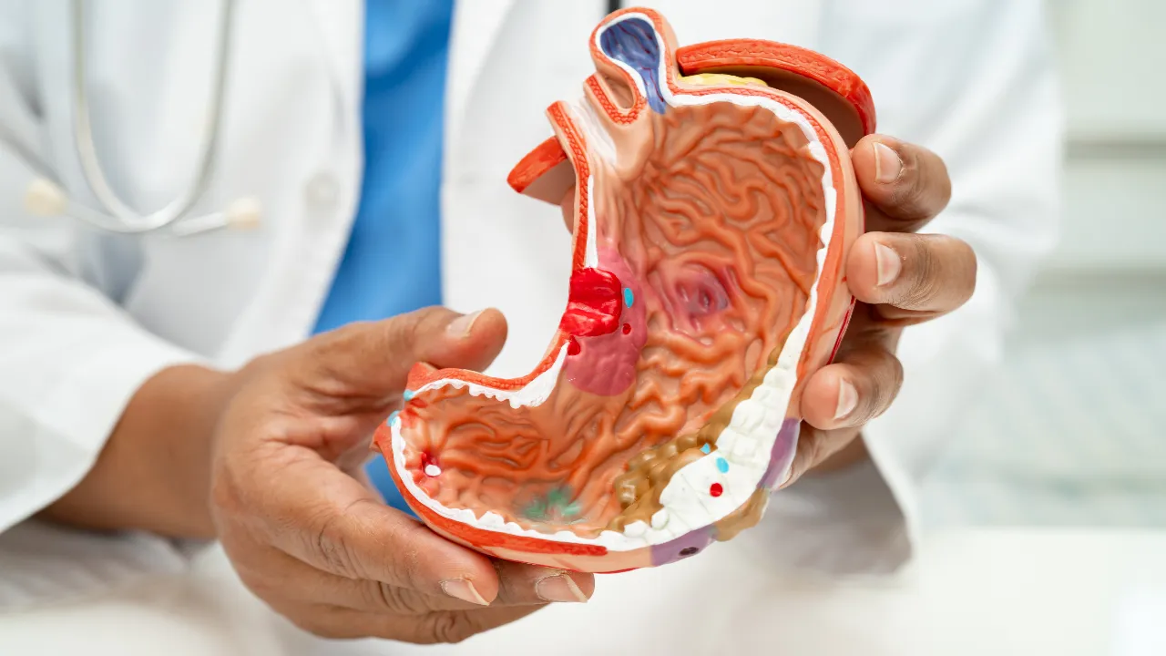 Gastric Problems