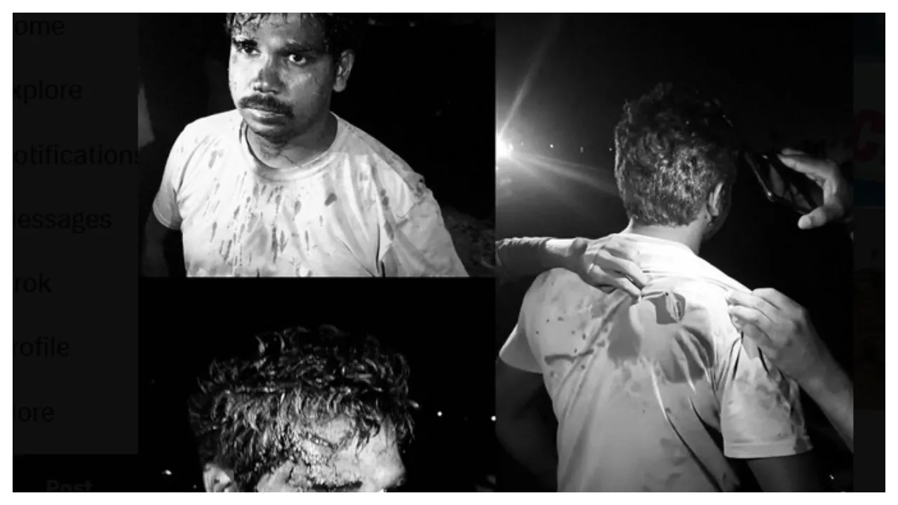 Unidentified Persons Attacked Constable   