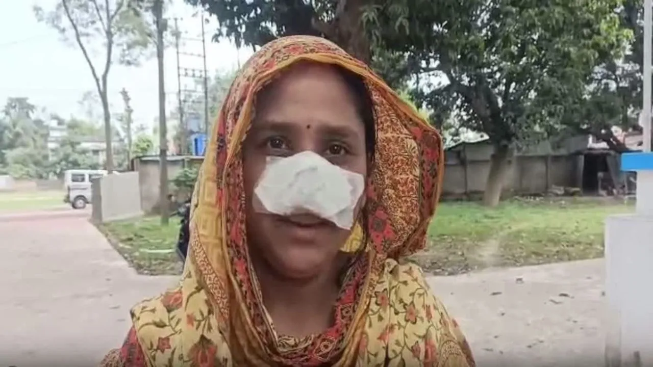 man bites off and swallows wife nose