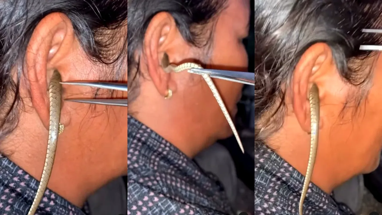 Snake In Woman Ear