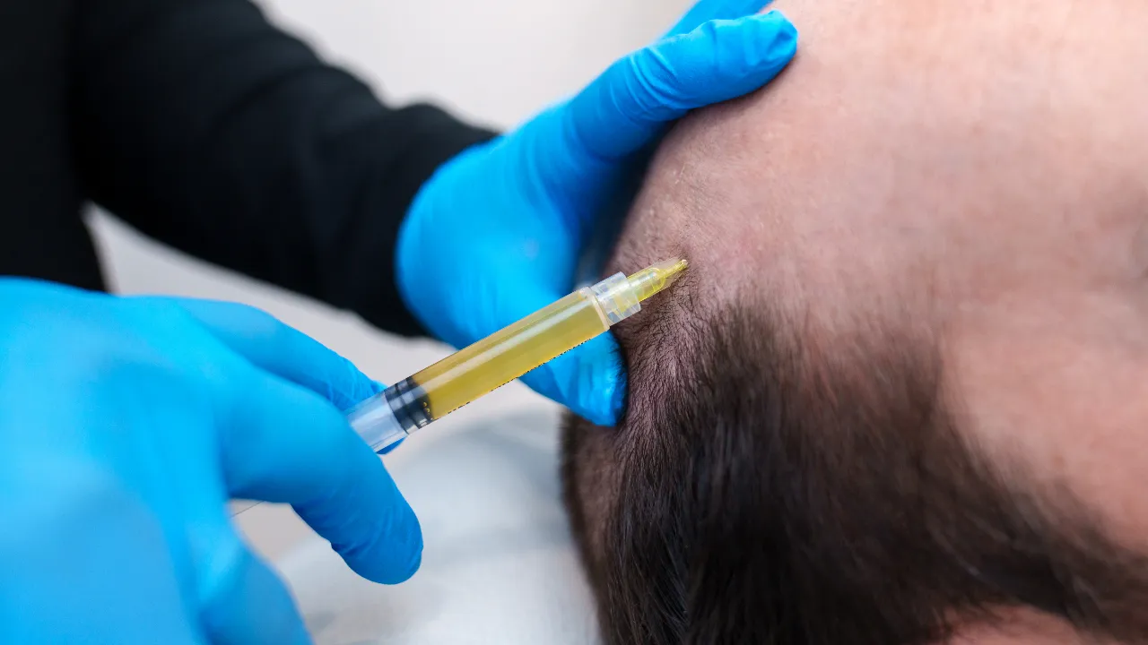 Hair Transplant