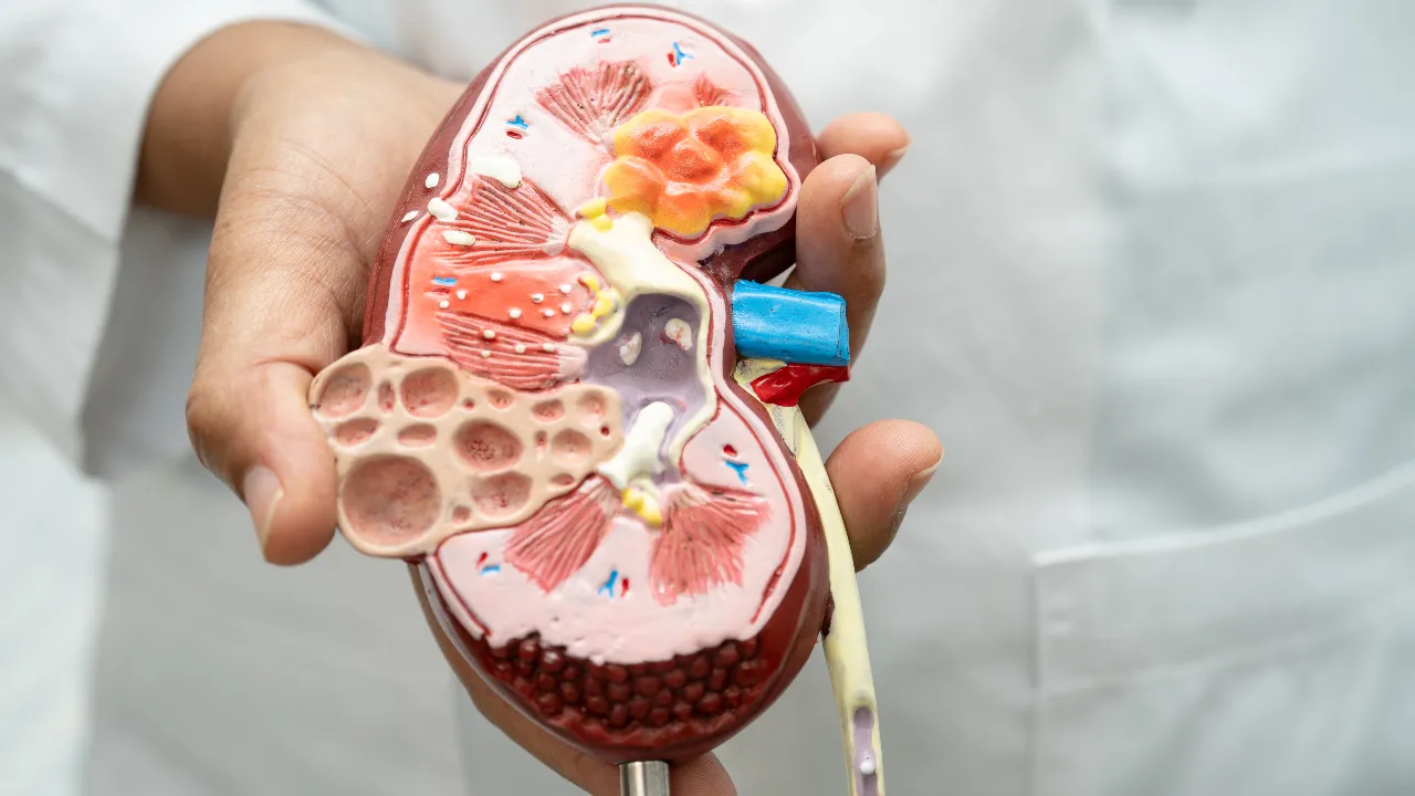kidney Problem Symptoms