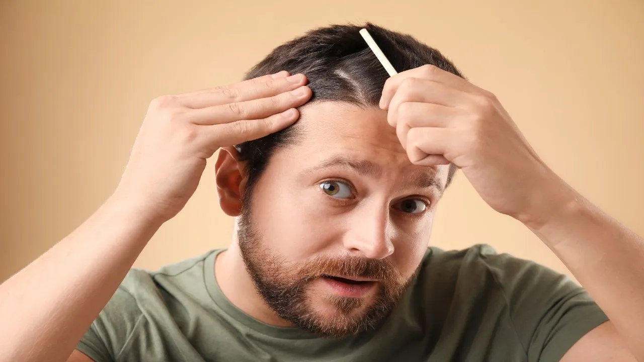baldspotshead2