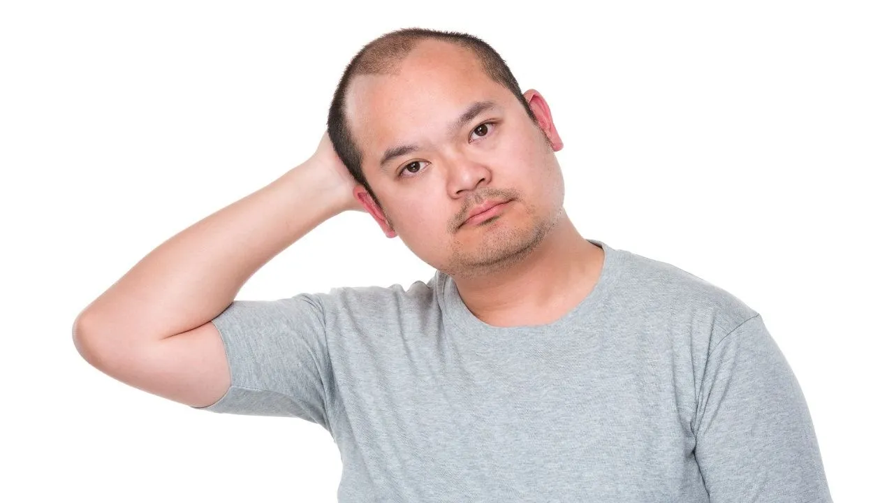 baldspotshead3