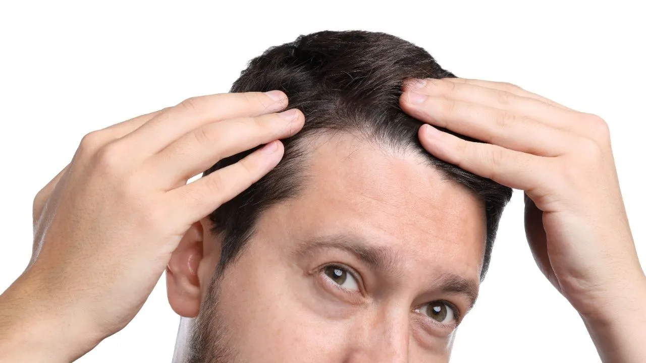 baldspotshead4