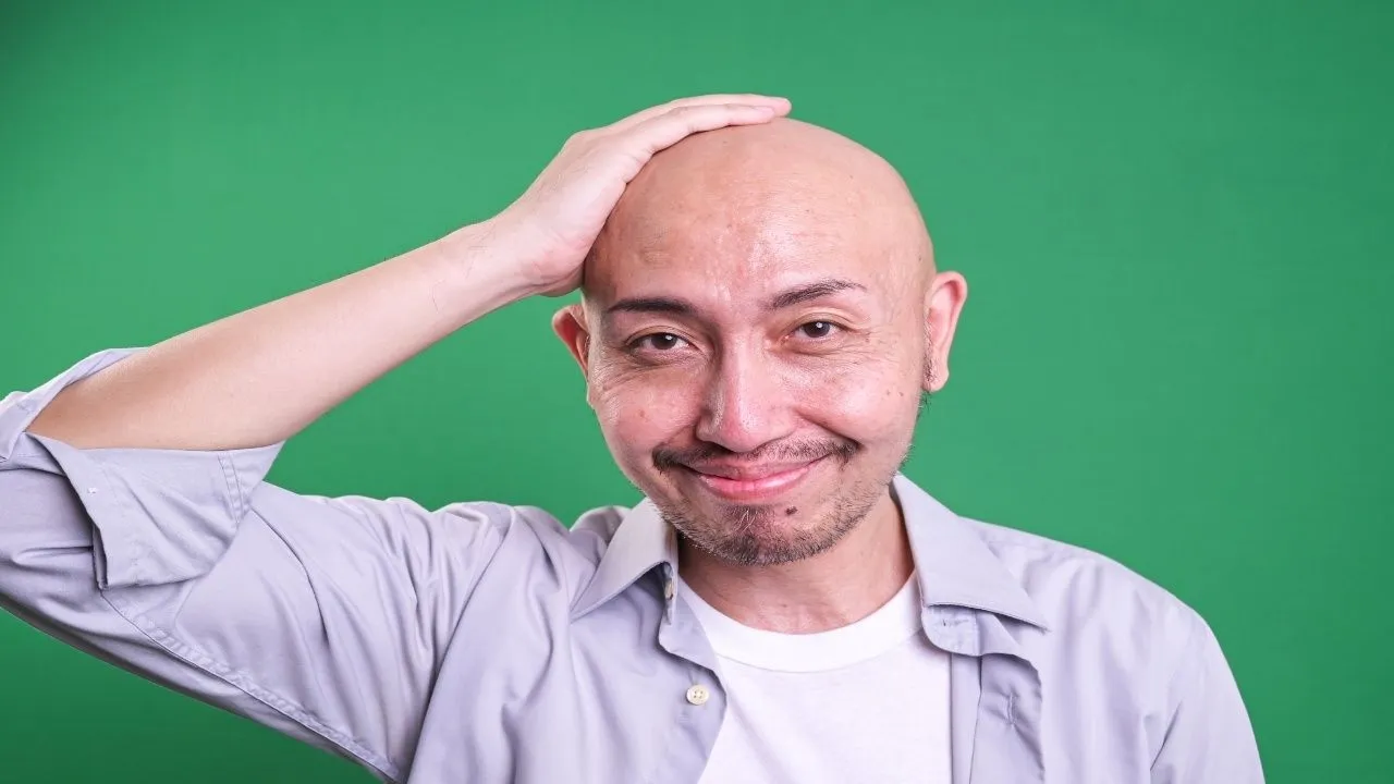 baldspotshead7