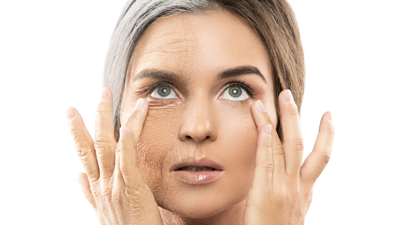 Premature aging of the skin