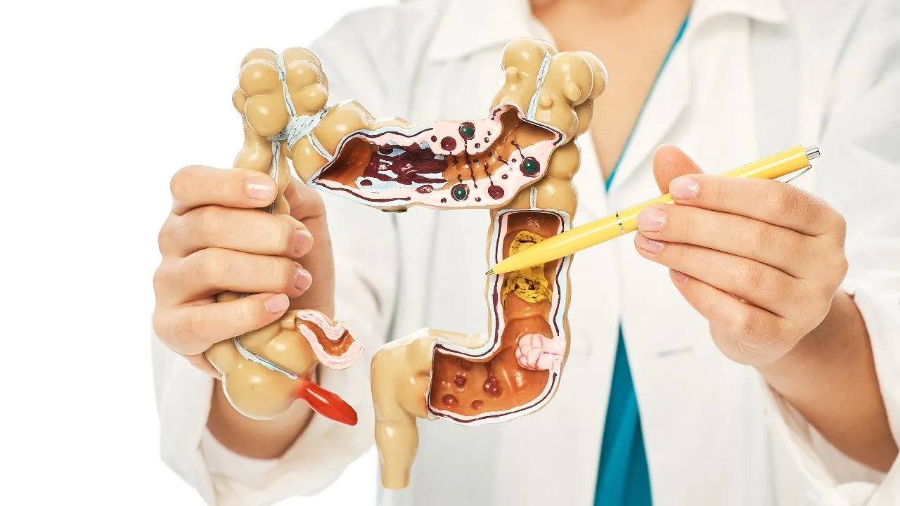 Stomach Worms