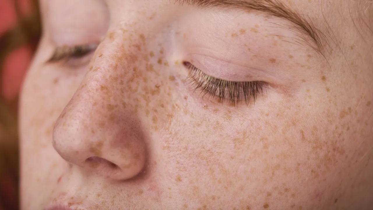 Face Spots
