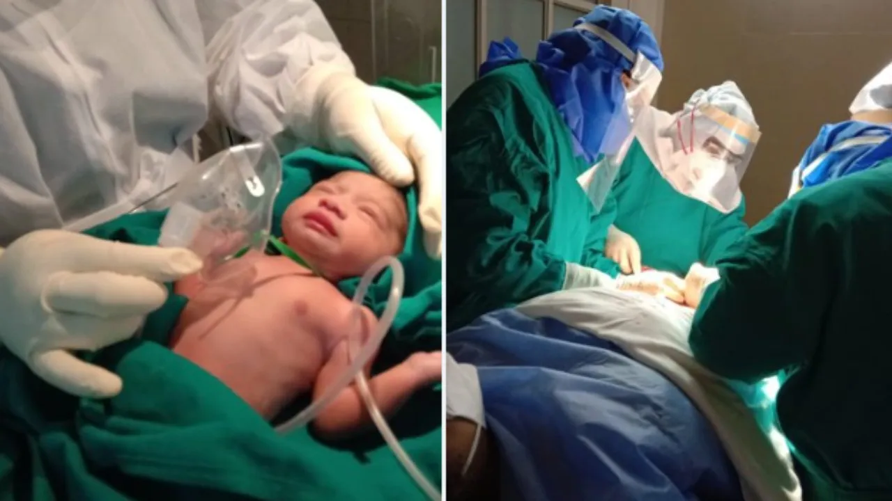 cesarean deliveries in India