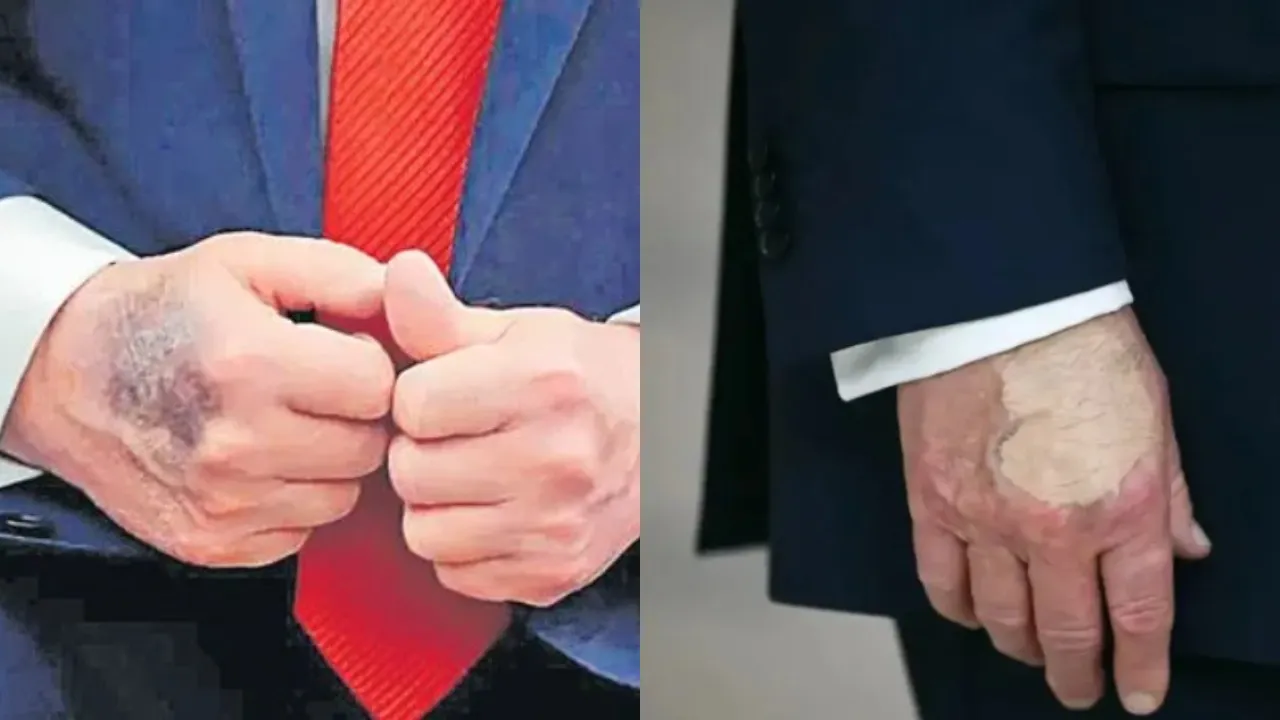 trump health