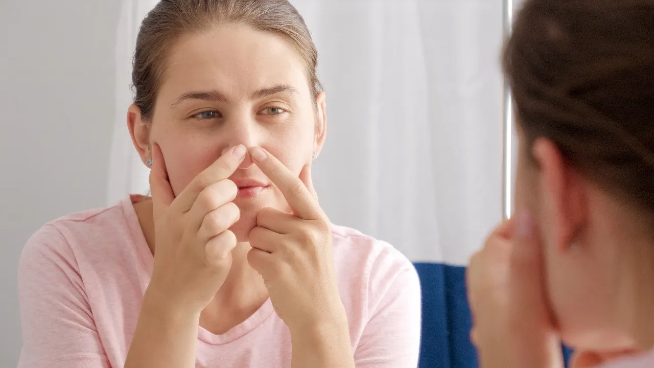 pimple nose
