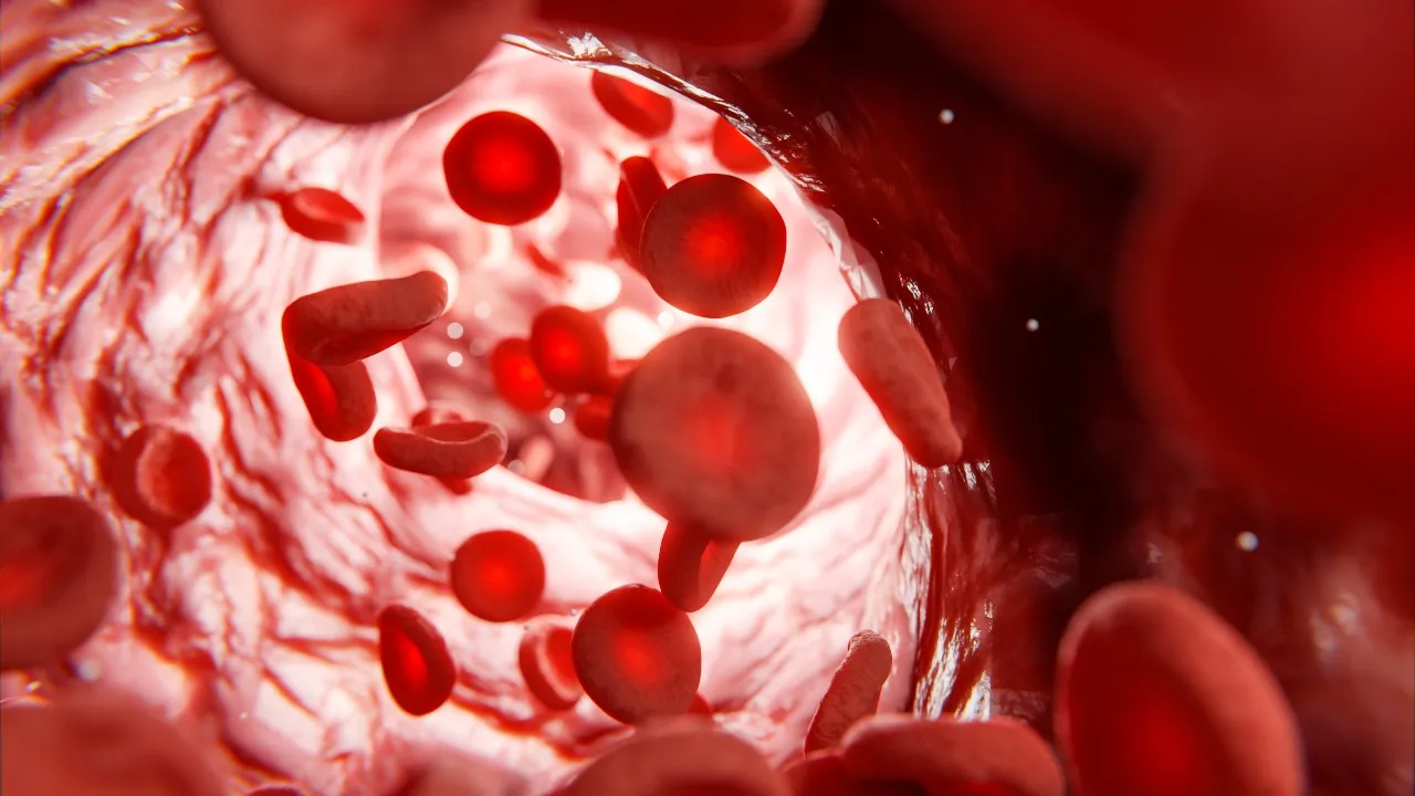 Dirty Cholesterol
