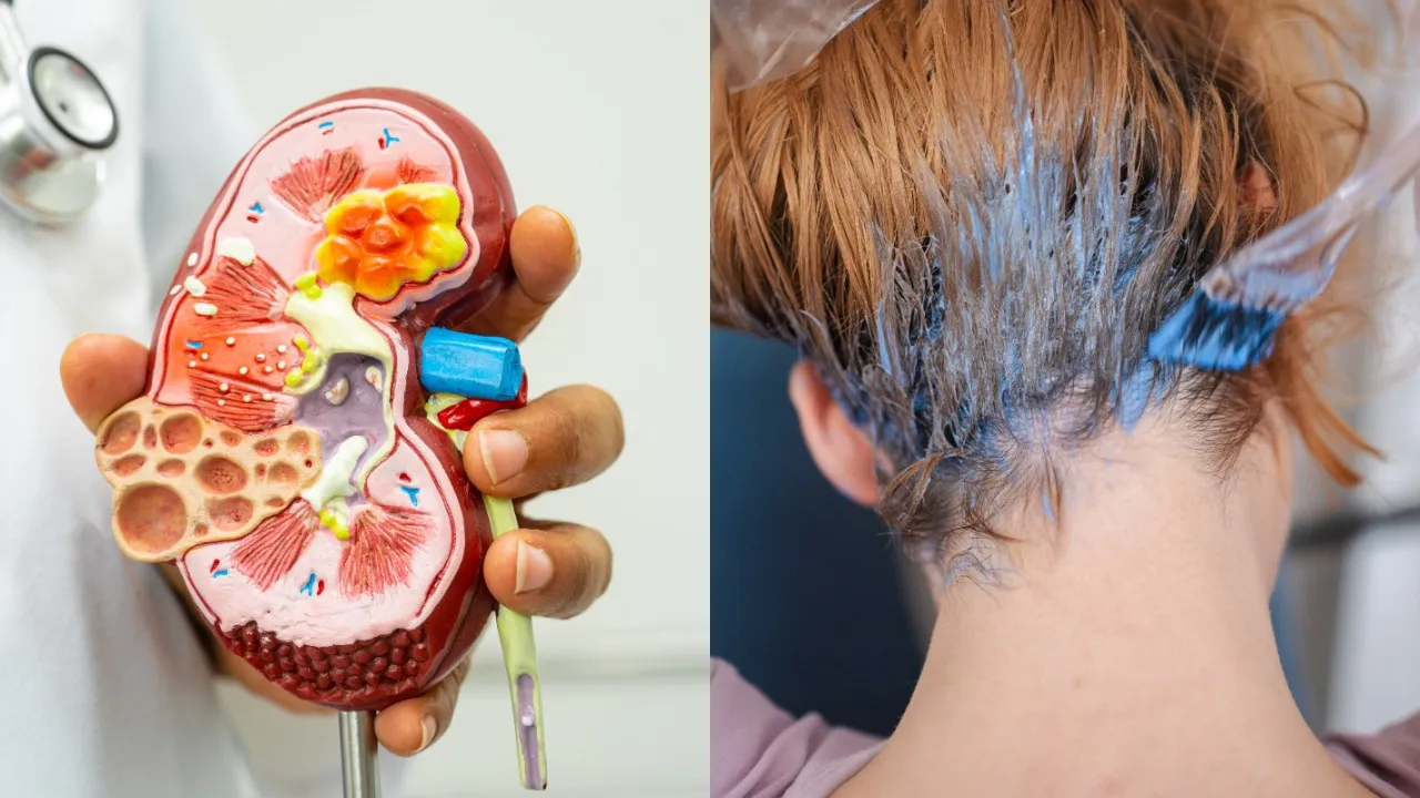 Kidney inflammation