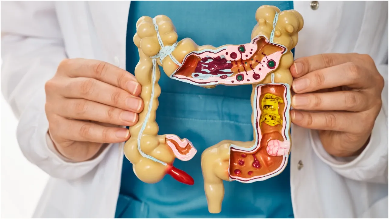 Digestive issues