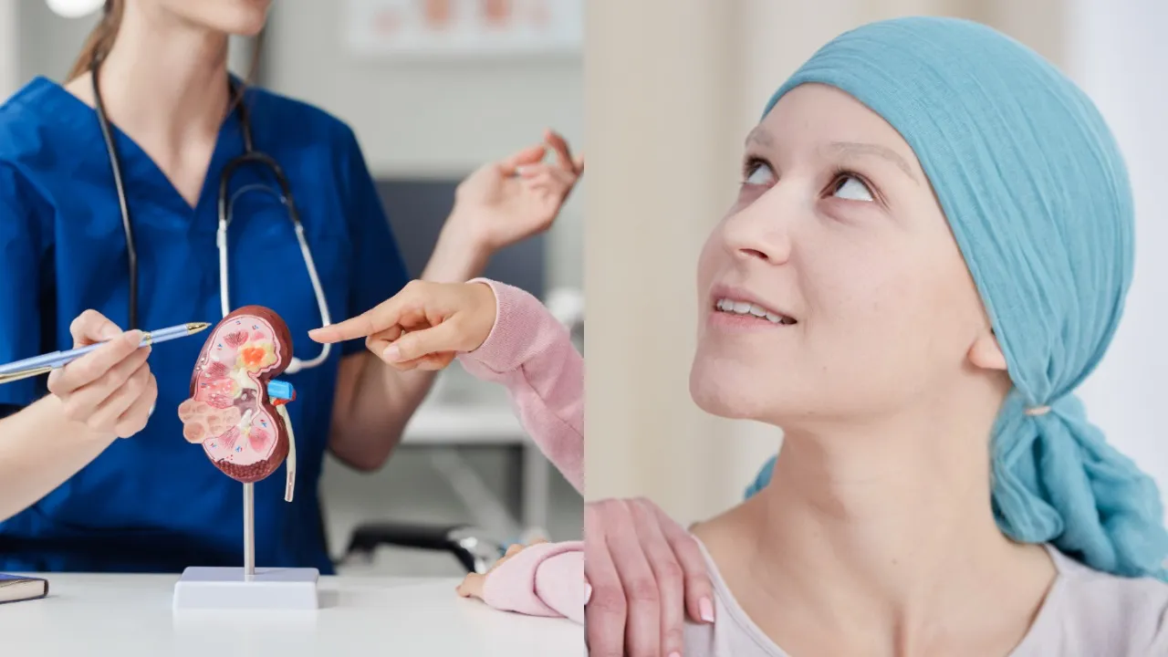 Kidney and cancer