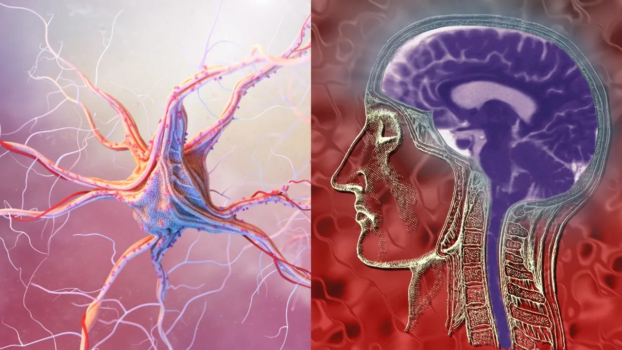 Parkinsons Disease