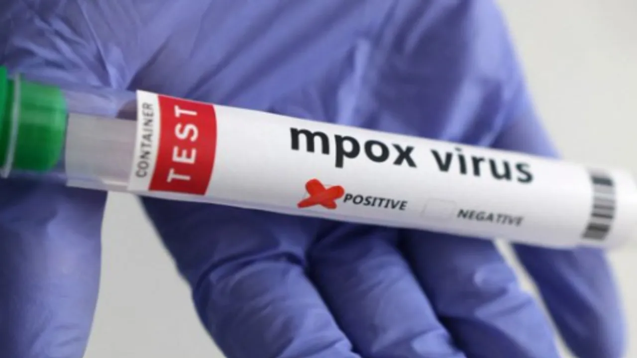Mpox