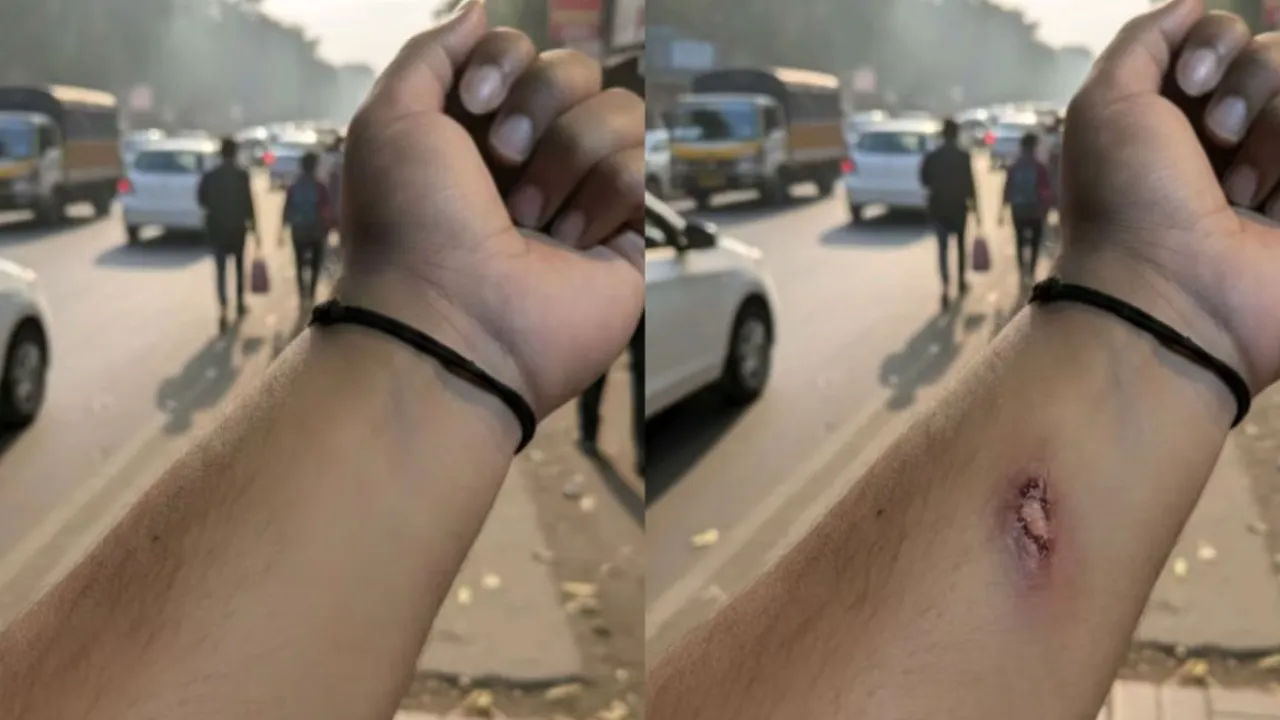 AI just broke HR, Employee uses Google’s Nano Banana AI tool to fake injury, HR approves paid leave