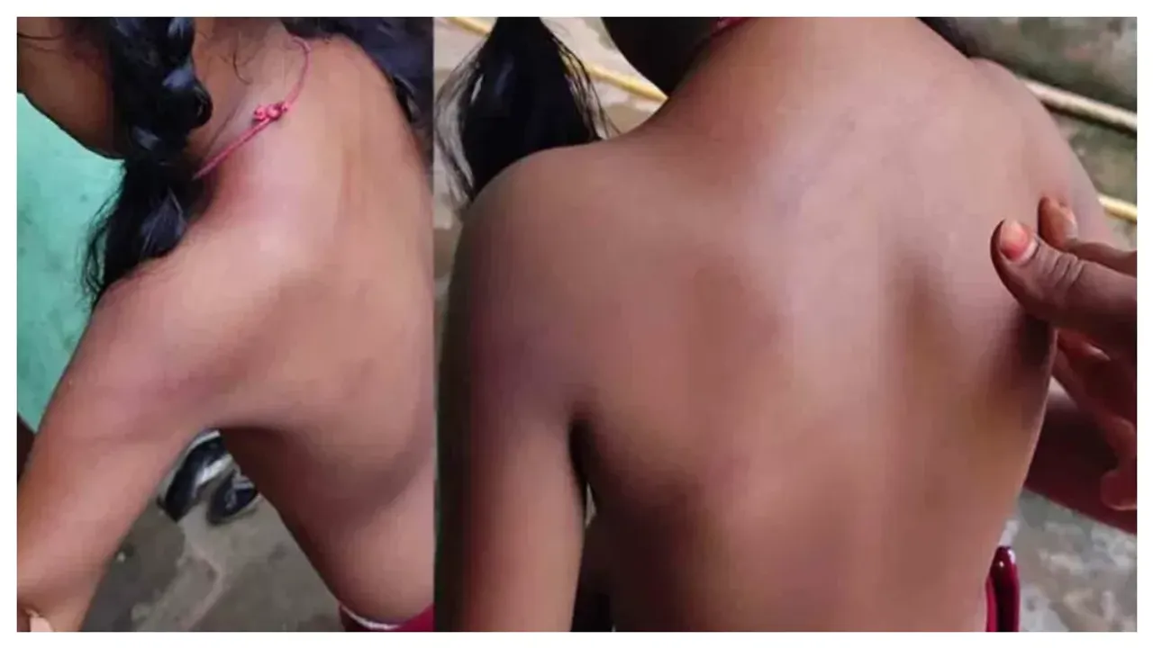 Teacher Beats 3rd class Students: హోమ్ వర్క్ చేయలేదని చిన్నారిని చితకబాదిన హెడ్ మాస్టర్