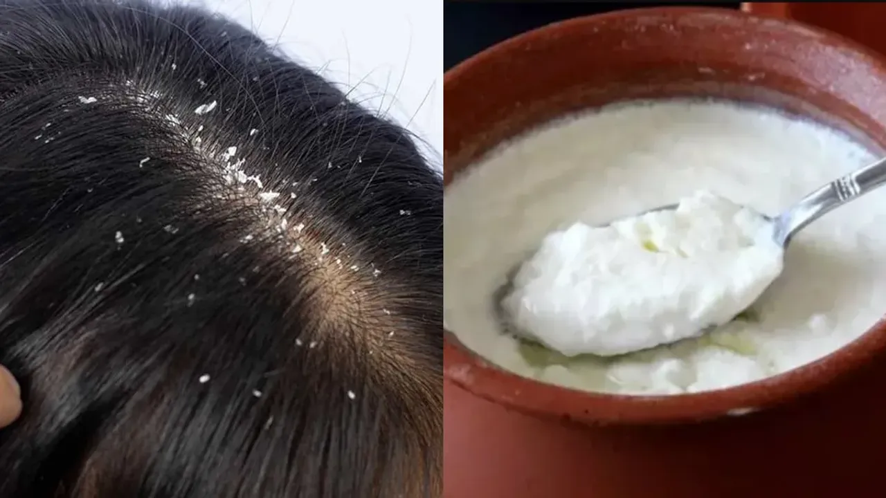 Yogurt Grow Hair: పెరుగుతో జుట్టు పెరుగుతుందా.. నిపుణులు ఏమంటున్నారు?