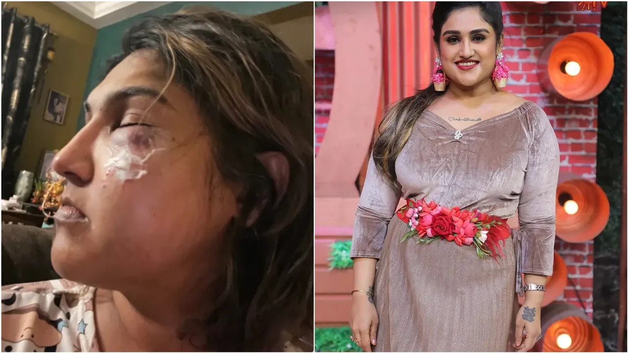 Vanitha Vijay Kumar: వనిత విజయ్ కుమార్ పై దాడి.. ఆ గొడవలే కారణమా?