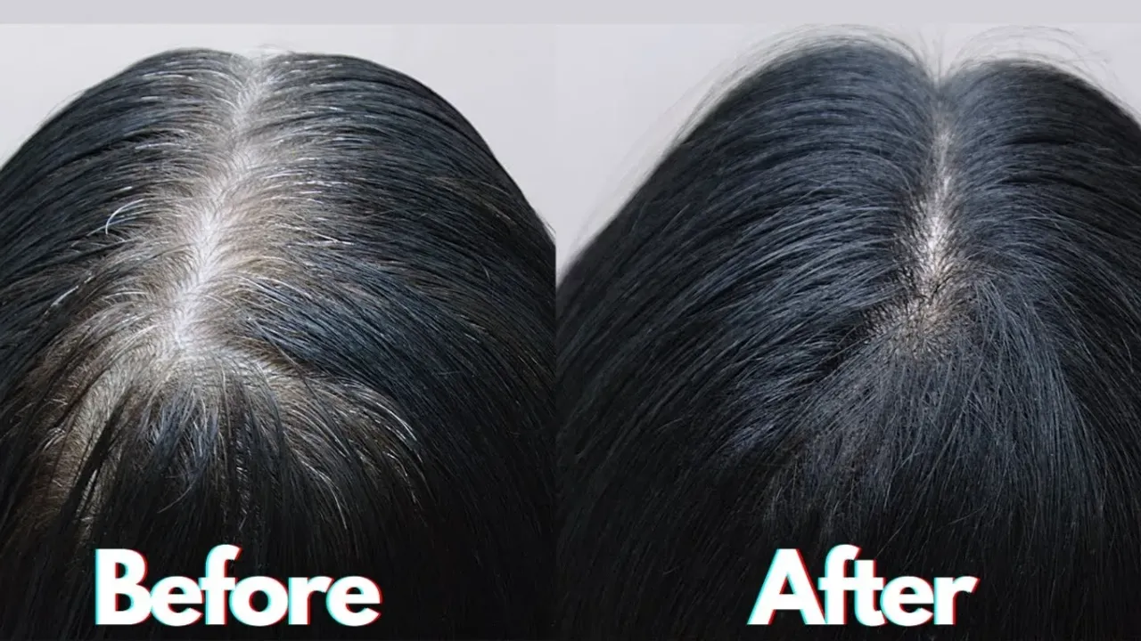White Hair Tips: ఇవి తింటే జన్మలో తెల్ల జుట్టు రాదు!