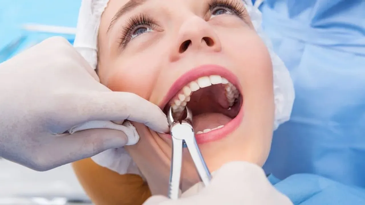 Wisdom Teeth Removed: తొందరపడి జ్ఞానదంతం తొలగించుకోవద్దు..వైద్యులు ఏమంటున్నారంటే