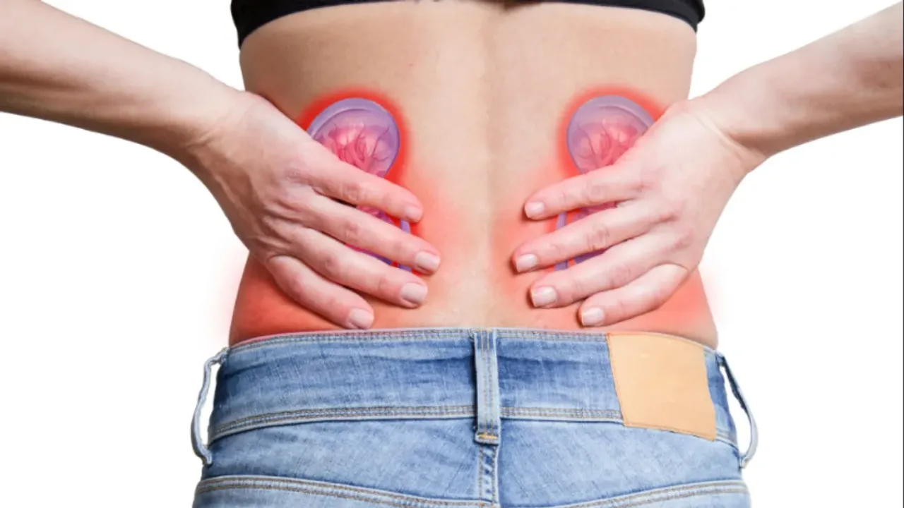 Kidney Stones: కిడ్నీ స్టోన్స్ ఉన్నాయా.. అయితే  ఇవి తప్పక తెలుసుకోండి